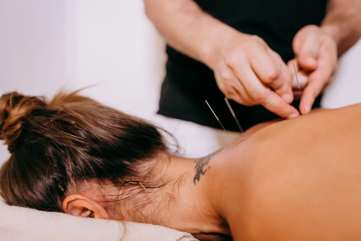 acupuncture  massage